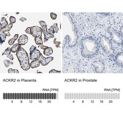 CC Chemokine Receptor D6 Antibody, Novus Biologicals 0.1mL; Unlabeled:Antibodies,